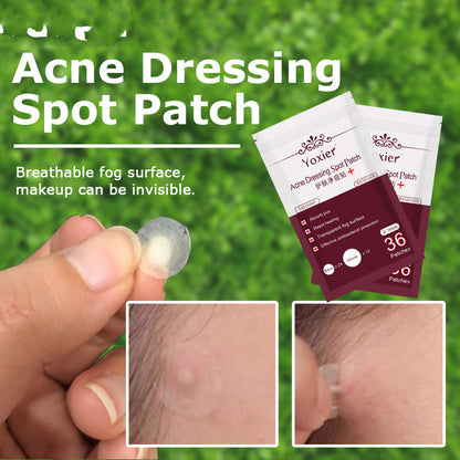 Skin Care Acne Dressing Spot Patch